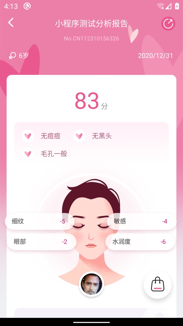 肌肤分析仪